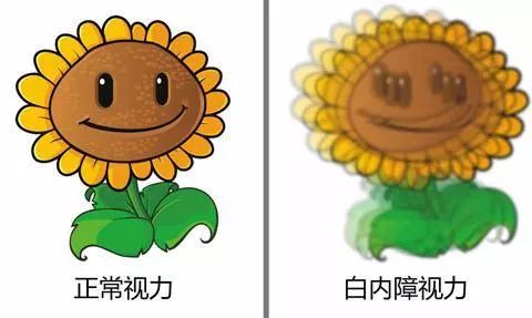白内障早期症状表现有哪些？该如何判断呢？